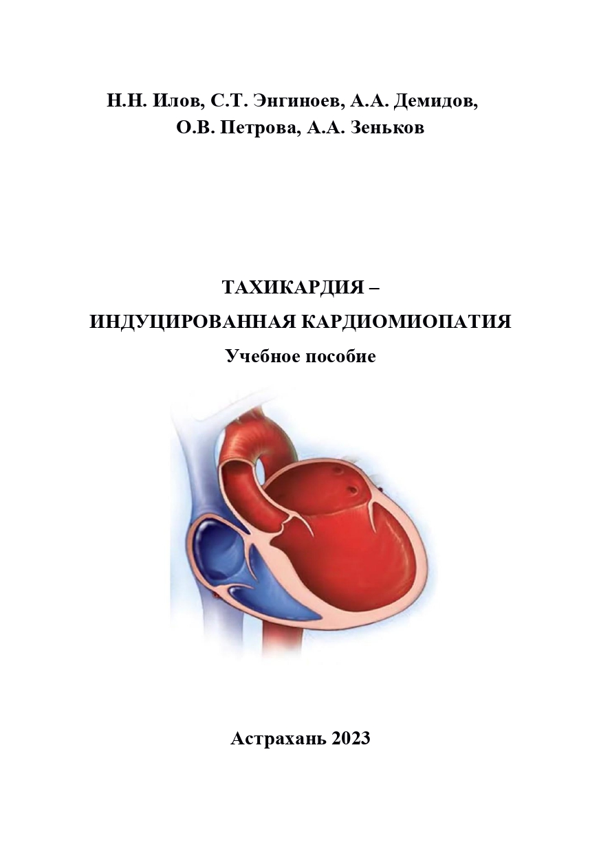 Тахикардия – индуцированная кардиомиопатия: учебное пособие.
