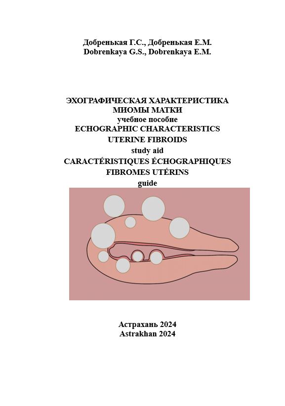 Эхографическая характеристика миомы матки: учебное пособие.
