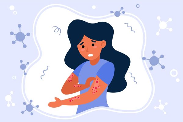 Чем опасна корь и почему нельзя отказываться от прививки: комментарий эксперта Астраханского ГМУ